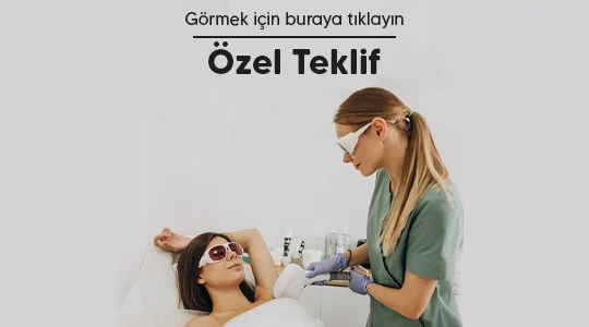 Teklif